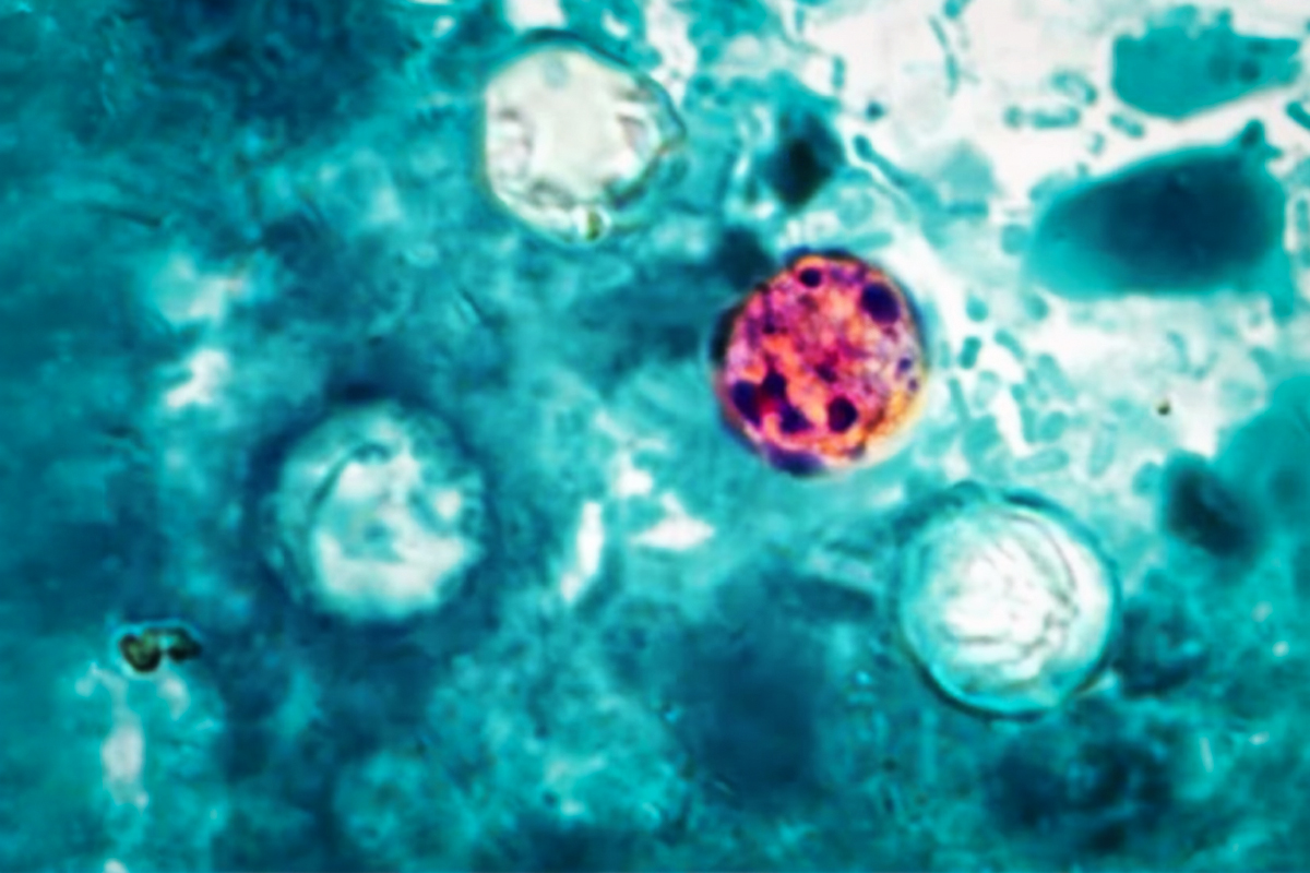 Former FDA Chief Says Central Mexico May Have Broad Cyclosporiasis Contamination - Produce Market Guide