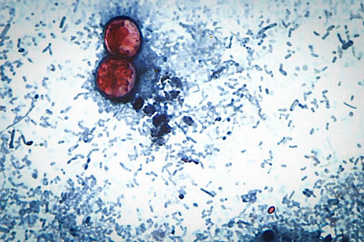 What a Cyclospora Outbreak in Fresh Produce Looks Like in a Post-FSMA 204 World - Produce Market Guide