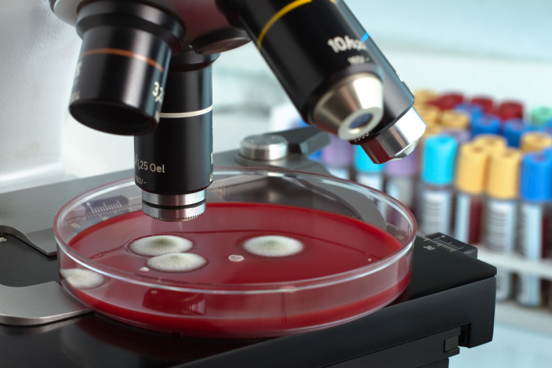 Petri dish, fungus