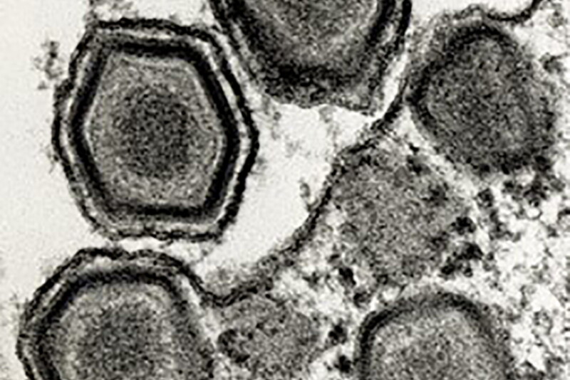 African Swine Fever ASF Virus