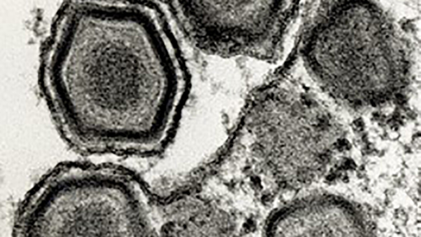 EU Epidemic Vets Assess African Swine Fever Outbreak in Spain