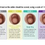 Factors such as hardness, color changes, swelling and abrasions figure into the assessment, which should be done immediately after the milking unit is removed from the animal. Each teat on the udder should be scored, using a scale of 1 to 4