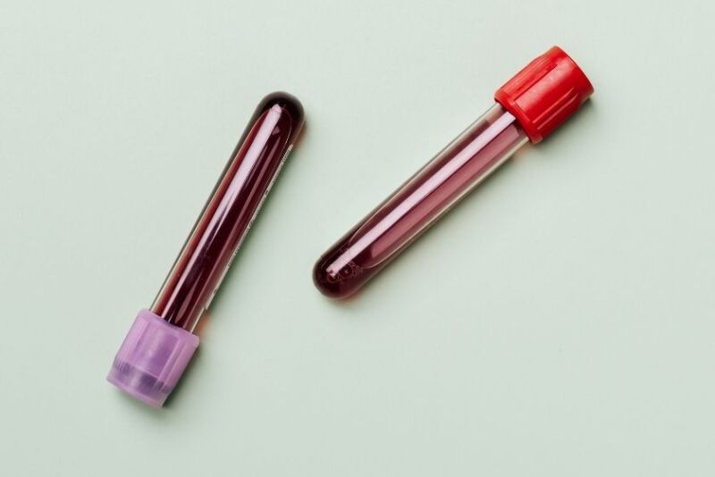 The cost of each test is $2.50. When equipment and shipping costs are added, the total expense per sample is about $3.22. 