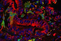 Genomic technology allowed Pirbright scientists to sequence and record the genetic code of each viral sample, which eliminates the need to maintain actual virus samples.