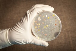 Anthrax-Disease-in-Humans.jpg