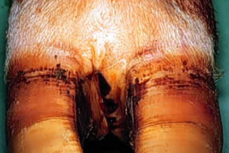 Footrot