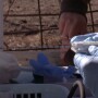 Liver Biopsies 