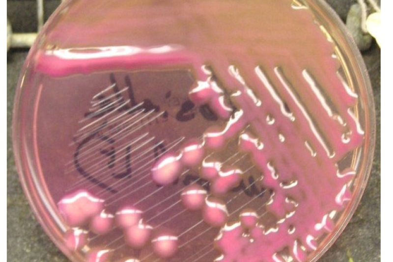 Klebsiella pneumoniae