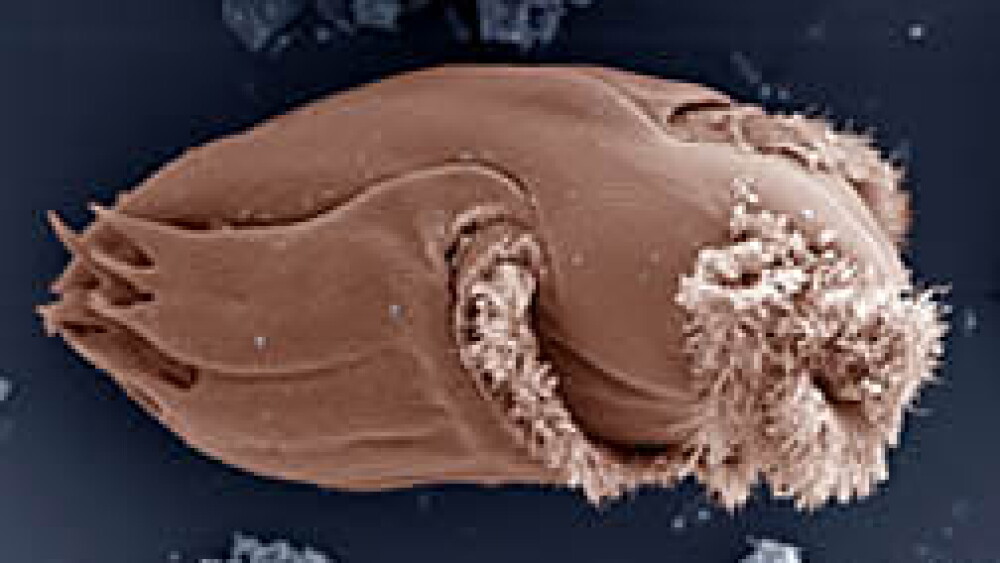 The protozoan Ophryoscolex spp. has a unique and complex cell structure. With an average length of 185 micrometers, it is one of the largest in the cow's rumen.