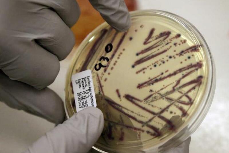 e_coli.jpg