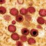 ASF Virus
