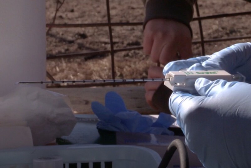 Liver Biopsies 