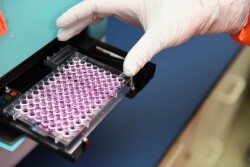 PCR testing improves detection of Histophilus somni, probably finding positive samples missed by culture methods. 