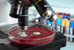 Petri dish, fungus