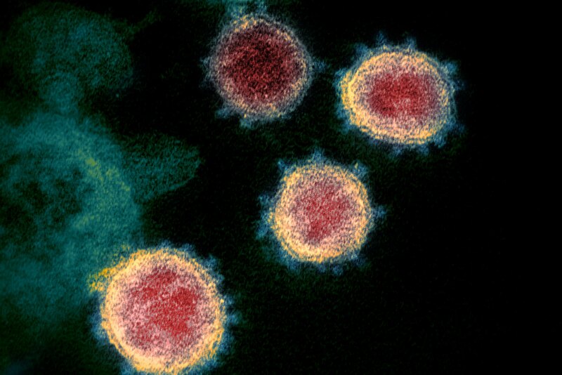 This transmission electron microscope image shows SARS-CoV-2—also known as 2019-nCoV, the virus that causes COVID-19—isolated from a patient in the U.S. Virus particles are shown emerging from the surface of cells cultured in the lab. The spikes on the outer edge of the virus particles give coronaviruses their name, crown-like. 