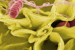 Salmonella by Canva.com