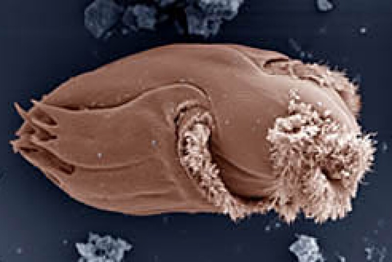The protozoan Ophryoscolex spp. has a unique and complex cell structure. With an average length of 185 micrometers, it is one of the largest in the cow's rumen.