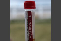 Individual samples would be required for most trichomoniasis testing under the proposed TAHC rules.