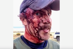 How much pain will a man endure to stay alive? On Oct. 1, 2016, Todd Orr answered the question in harrowing detail. 
