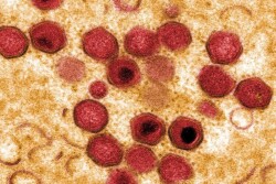 ASF Virus