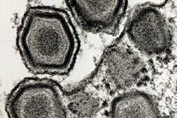 ASF Virus Dr Rock