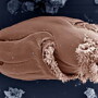 The protozoan Ophryoscolex spp. has a unique and complex cell structure. With an average length of 185 micrometers, it is one of the largest in the cow's rumen.