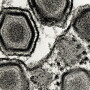 ASF Virus