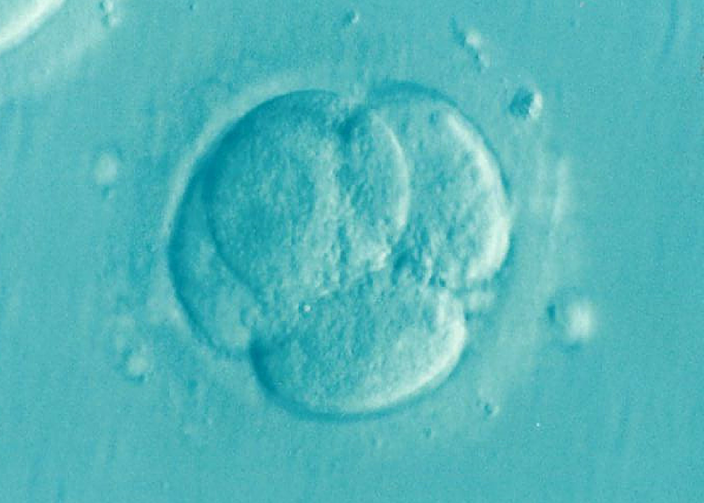 Embryo