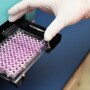 PCR testing improves detection of Histophilus somni, probably finding positive samples missed by culture methods. 