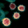 This transmission electron microscope image shows SARS-CoV-2—also known as 2019-nCoV, the virus that causes COVID-19—isolated from a patient in the U.S. Virus particles are shown emerging from the surface of cells cultured in the lab. The spikes on the outer edge of the virus particles give coronaviruses their name, crown-like. 