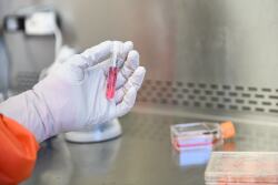 With exports of U.S. swine, cattle and dairy products totaling more than $19 billion in 2017, the GAO warned that those shipments after an outbreak of foreign disease “would likely stop or be sharply reduced. Moreover, in a widespread outbreak, the scale of federal compensation payments could be substantial.”

