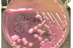 Klebsiella pneumoniae