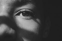 Eye