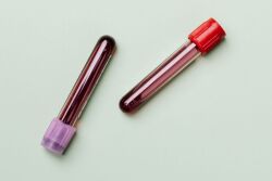 The cost of each test is $2.50. When equipment and shipping costs are added, the total expense per sample is about $3.22. 