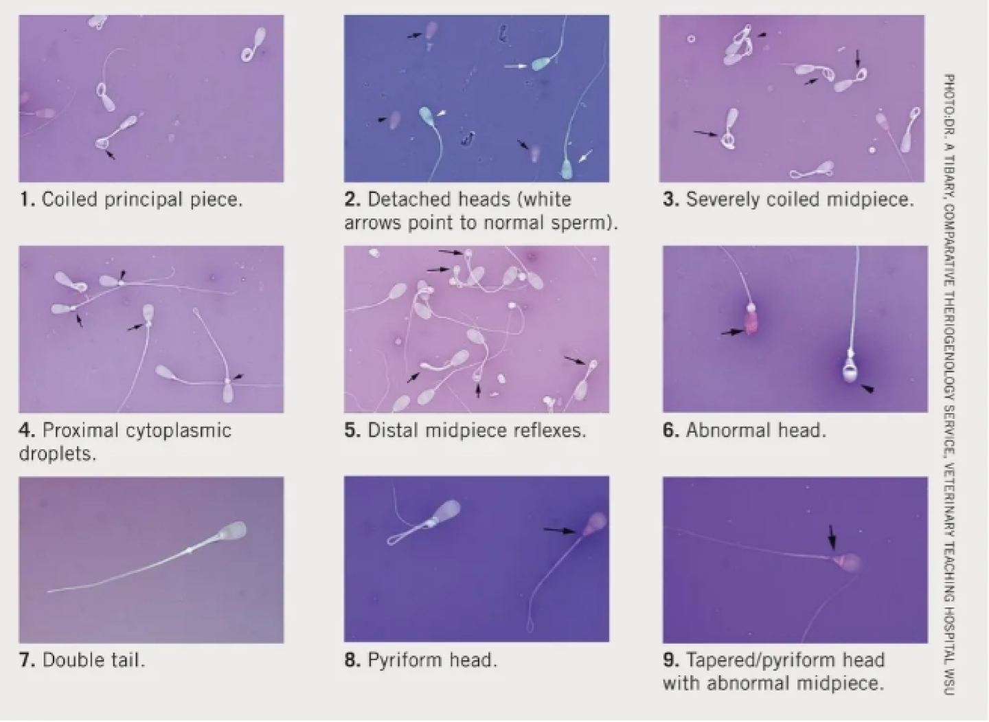 sperm%20abnormalities.PNG