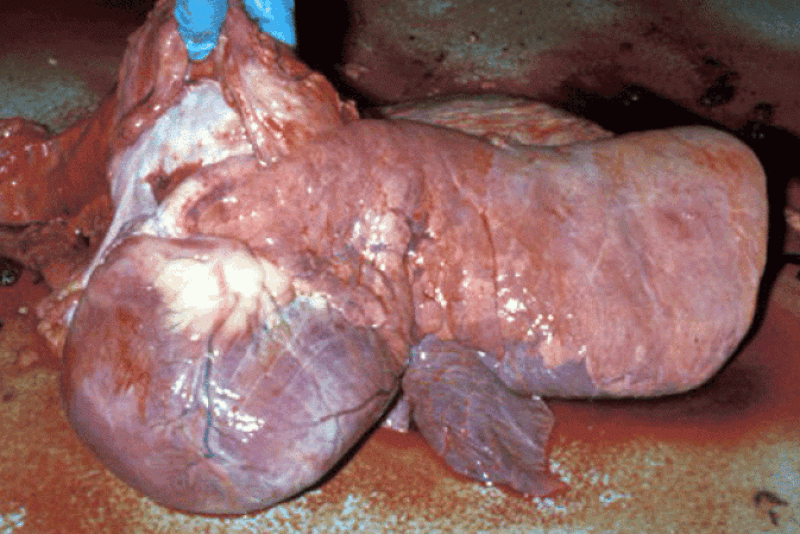 Necropsy image shows the effects of right heart failure associated with bovine pulmonary hypertension.