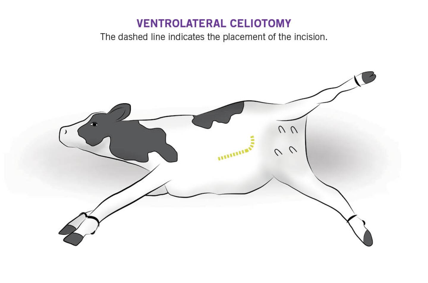 Ventrolateral%20celiotomy.jpg