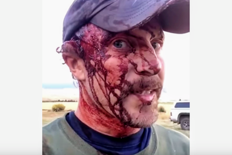How much pain will a man endure to stay alive? On Oct. 1, 2016, Todd Orr answered the question in harrowing detail. 
