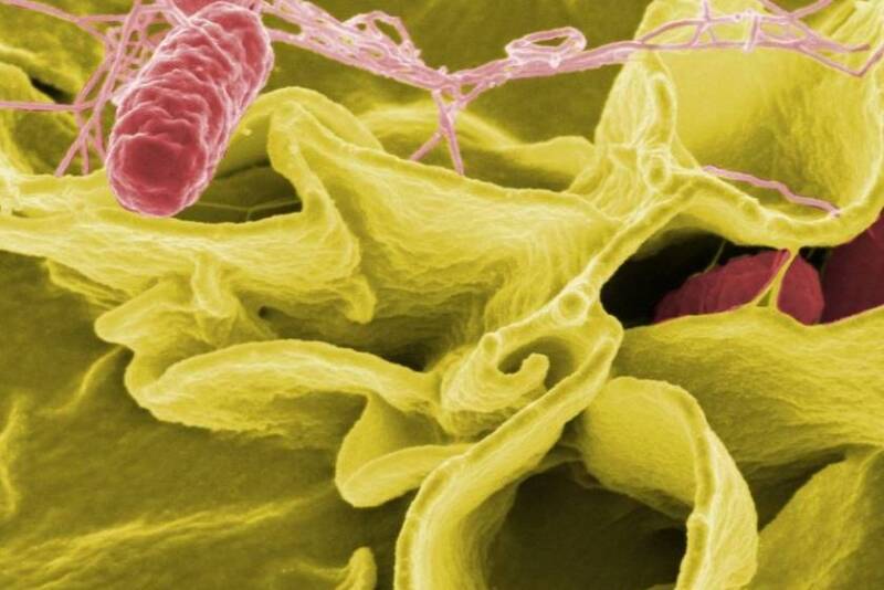 Salmonella by Canva.com